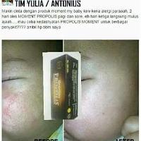 Propolis denga sejuta manfaat nya-fb_img_1506091517109.jpg