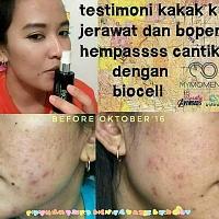 Biocel Moment untuk perawatan wajah dan tubuh-fb_img_1520111798660.jpg