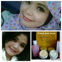 Florin skincare,,,,(cocok bagi ibu hamil) aman no pengelupasan-394266_159139527593105_157944706_n.jpg