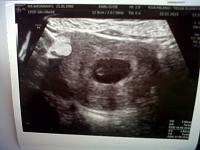 rahim dan janin ketekan k dalem di usia 12w gara" levis :'(-gunung-20toar-20150122-00311.jpg