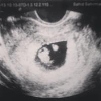 kehamilan 7w sudah terdengar detak jantung-7-minggu.jpg