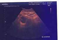 tanda tanda hamil sudah dirasakan TP negatif-hasil-usg-q.jpg