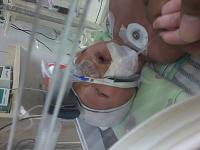 Bayiku Terlahir Premature dengan ASPHIXIA - Foto-20150909_121053.jpg