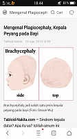 kepala peyang pada bayi-screenshot_2016-09-03-18-44-21-155.png