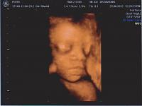 4D kehamilan 7 bulan, dan Alhamdulillah 100% baby girl :)-527936_241911909245013_1760455844_n.jpg