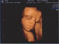 4D kehamilan 7 bulan, dan Alhamdulillah 100% baby girl :)-523758_241911715911699_1495684151_n.jpg