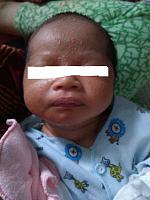 cara menghilangkan jerawat pada bayi baru lahir-img_20180109_134434.jpg