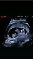 Alhamdulillah, penantian 6tahun berujung hamil kembar 🥺🖤-4f0ffacd-3c52-43c4-8561-5254a7ad670f.jpg