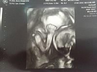 Hamil kembar 22 minggu, si kembar jagoan semua!! Aaaaah bahagianyaa.. :)-image.jpg
