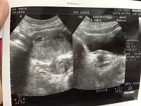 Kehamilanku 4weeks5days :)-image.jpeg