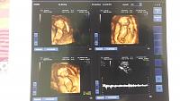 Bundaaaa...perkiraan dokter baby boy niihh!!-20140423_204352.jpg