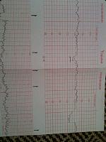 Warning dokter! Detak jantung janinku sangat cepat help me bunda-capturenux-202014-09-21-2008.23.27.jpg