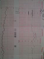 Warning dokter! Detak jantung janinku sangat cepat help me bunda-capturenux-202014-09-21-2008.23.43.jpg
