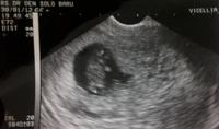 Dokter ketiga dalam kehamilan 9 minggu-untitled.jpg