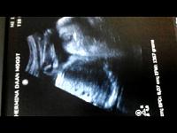 Pentingnya USG saat Kehamilan triSemester awal dan Trismester Akhir-screen_20140913_134650.jpg