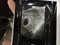 Ibu hamil kembar ngumpul disini yuuuk :)-image.jpg
