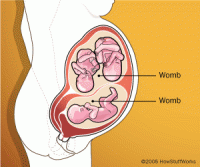 diskusi tentang rahim ganda-double-womb-1.gif