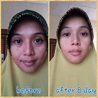 skincare apa ya yg aman buat bumil..-skin-care-set1.jpg