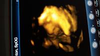 Hasil usg 4D, uk 30weeks-20170329_194826.jpg