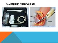 Yg Promil apa kabar dengan Agustus?-pemeriksaan-diagnostik-21-638.jpg