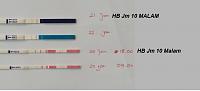 Test lh ovulation-ovu-tes.jpg