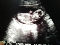 hasil usg : baby GIRL :)-17-minggu.jpg