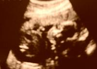 hasil usg : baby GIRL :)-20-minggu.jpg